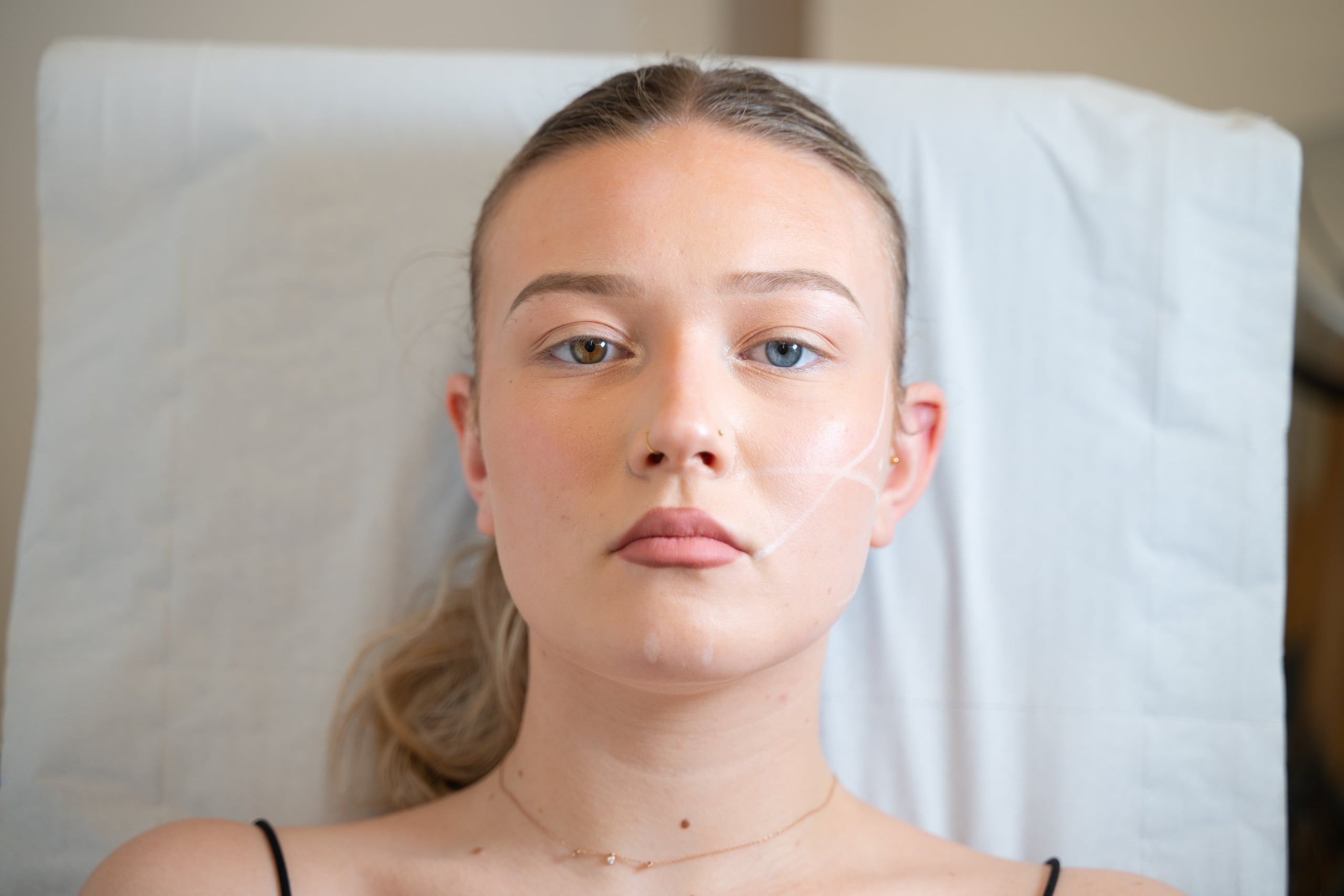 Relâchement cutané du visage : options réalistes