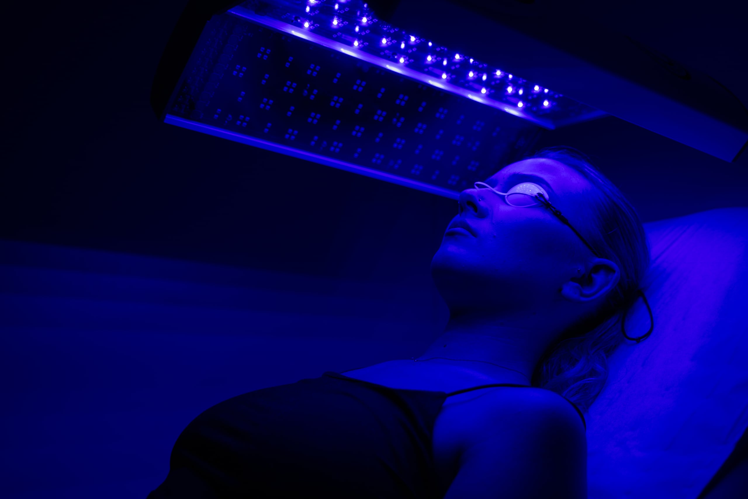 Luminothérapie LED : acné légère, rougeurs et attentes réalistes